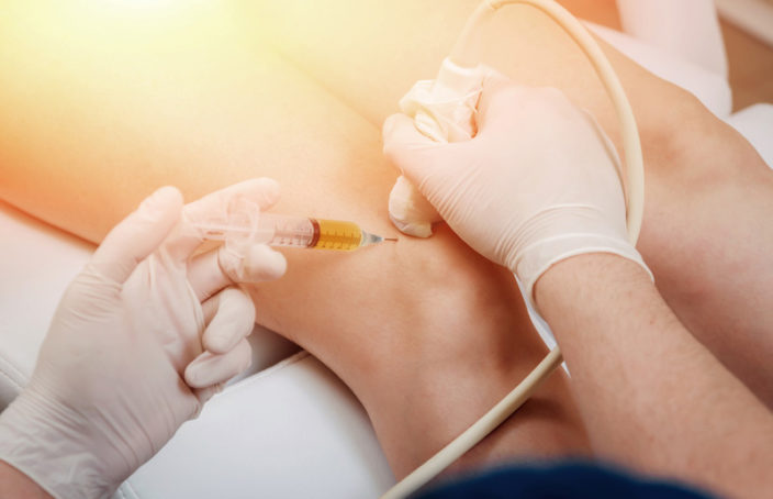 Renuvi Procedures